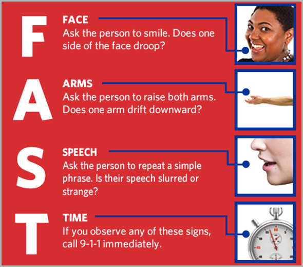 The six signs of a stroke that AREN'T the ones you've been told about
