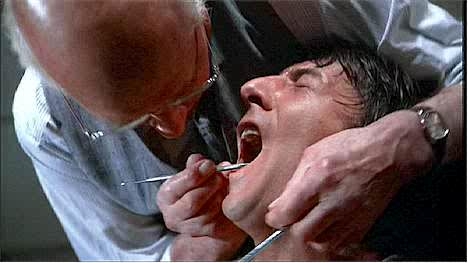 marathon-man-dental-scene