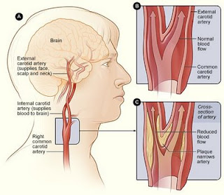 cad_anatomy