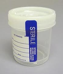 urine cup