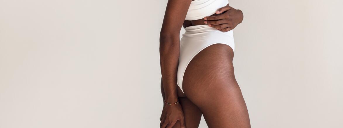 Black Woman In White Lingerie with stretch marks