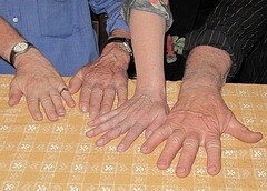 hands