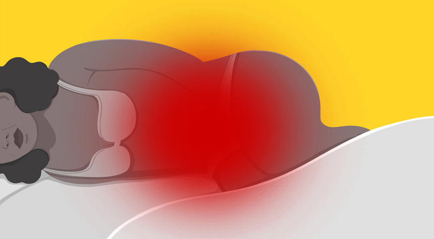 illustration of woman laying down with pain around pelvic area, menopause pain