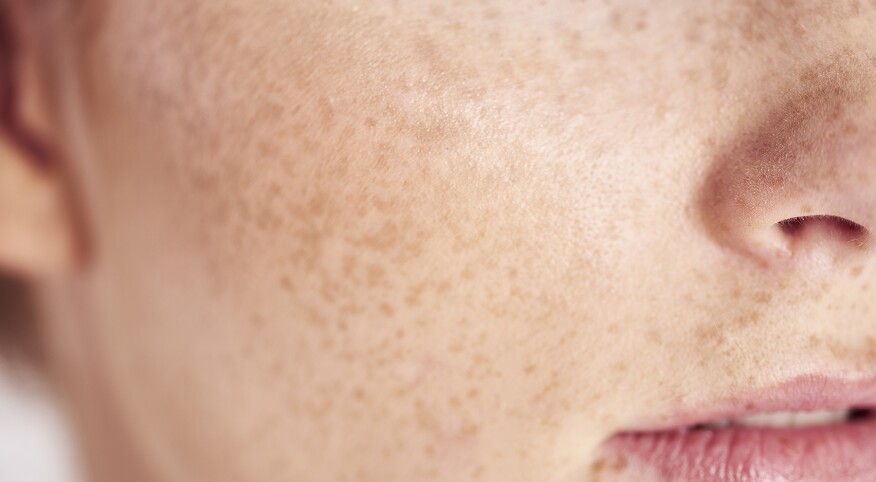 Close up of woman's face with freckles