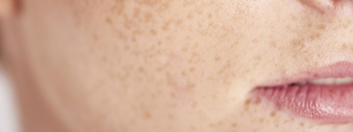 Close up of woman's face with freckles