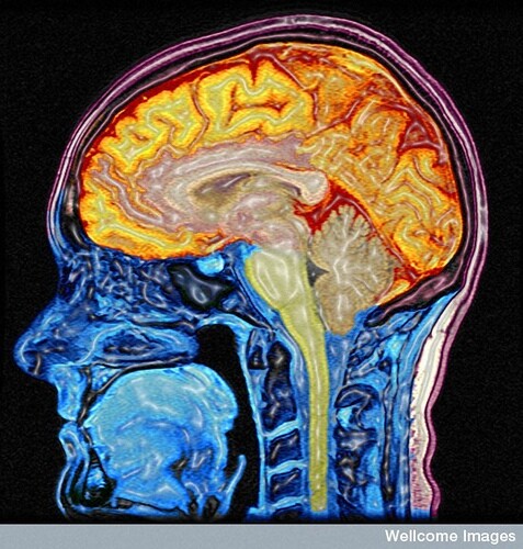 brain scan image