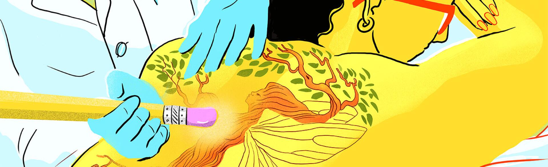 illustration_tattoo_being_removed_jade_schulz_1440x584.jpg
