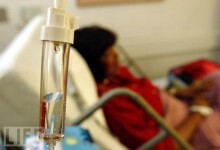 chemo