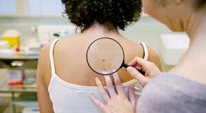 Dermatologist using magnifying class to look at woman's back