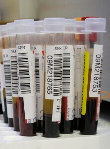Blood_testwiki-222x300