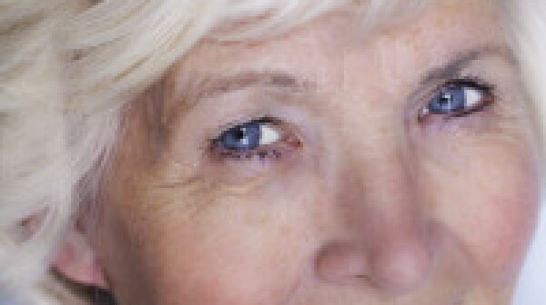 Older women stroke risk