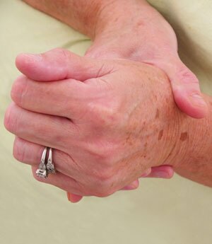 arthritis_hands2