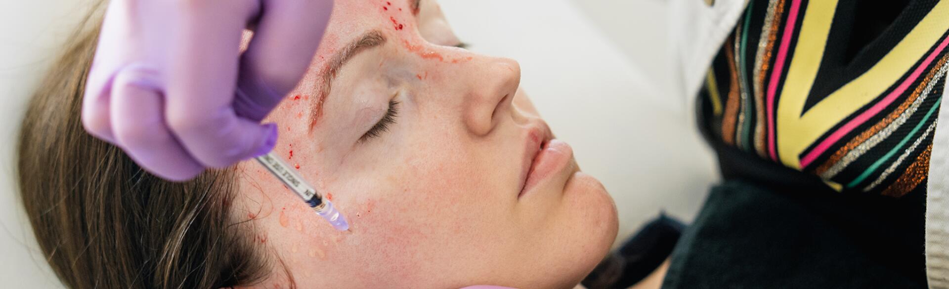 Revolutionary treatment of rejuvenation with blood plasma