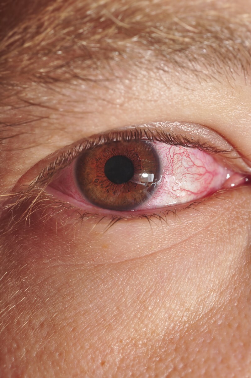 iStock_000017130260Medium