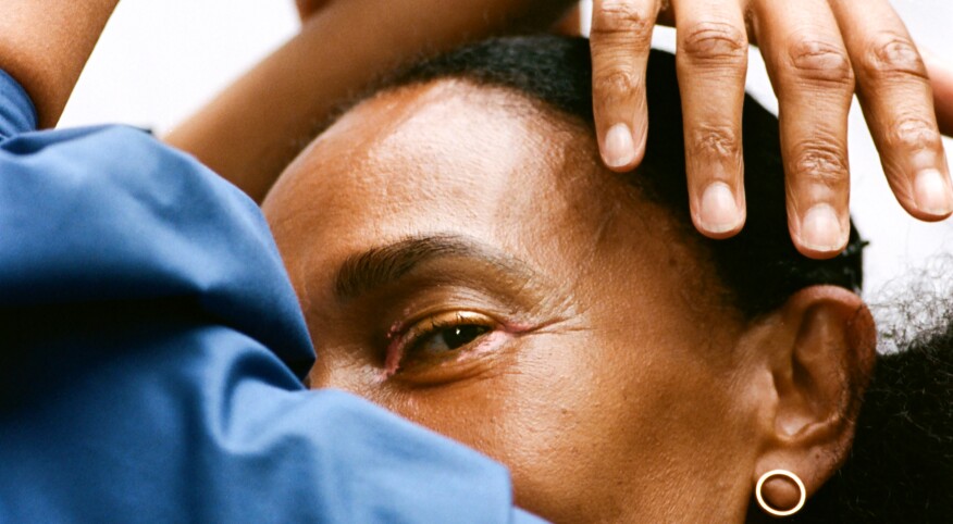 Woman in blue shirt with hands on her head and left eye showing