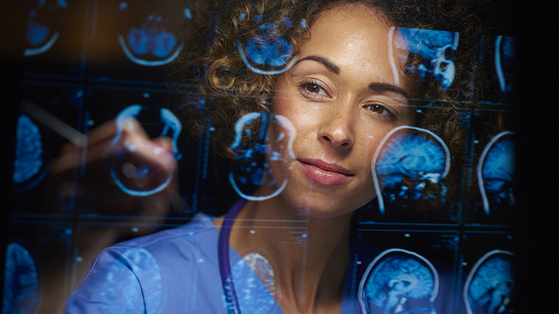 A female doctor looking at MRI scans of human brains